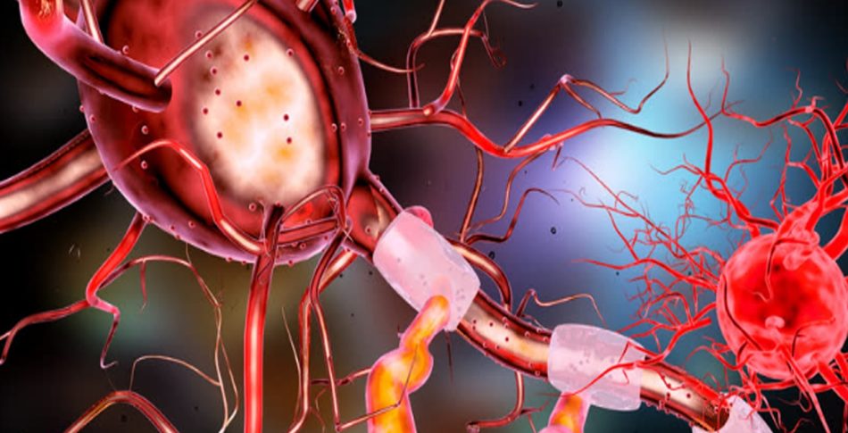 Löpning skapar BDNF som förbättrar minnet